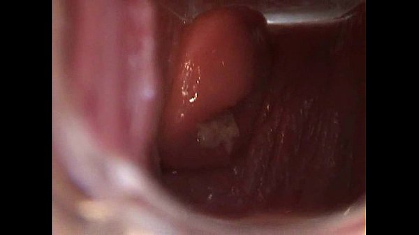 Avy Open Pussy with Speculum