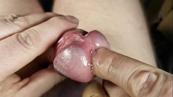 Pre-ejaculate