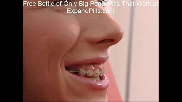 Sandra Skinny Teen Braces Anal Facial
