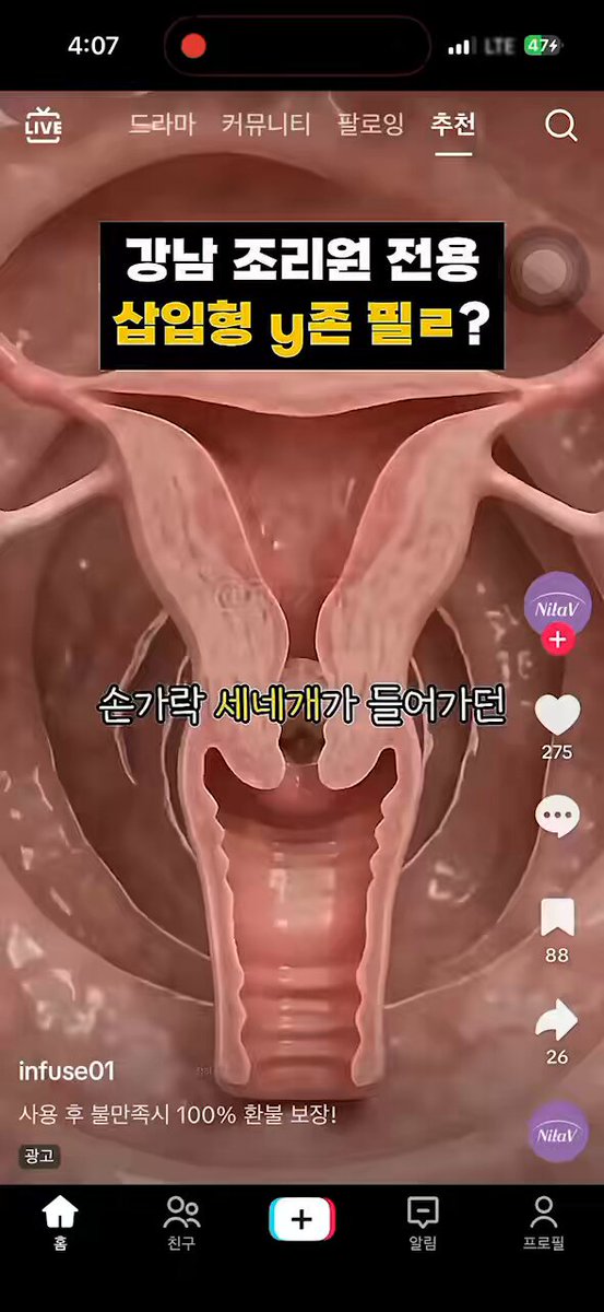 Dr.페퍼 /랜턴스 스포일러