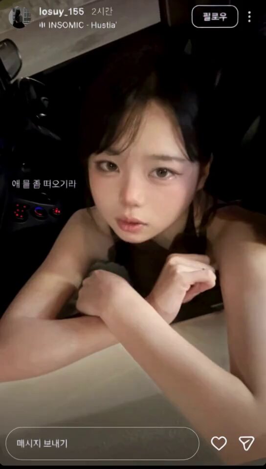 ㅈㅇㅂㅈ 꼴ㄴ 고정